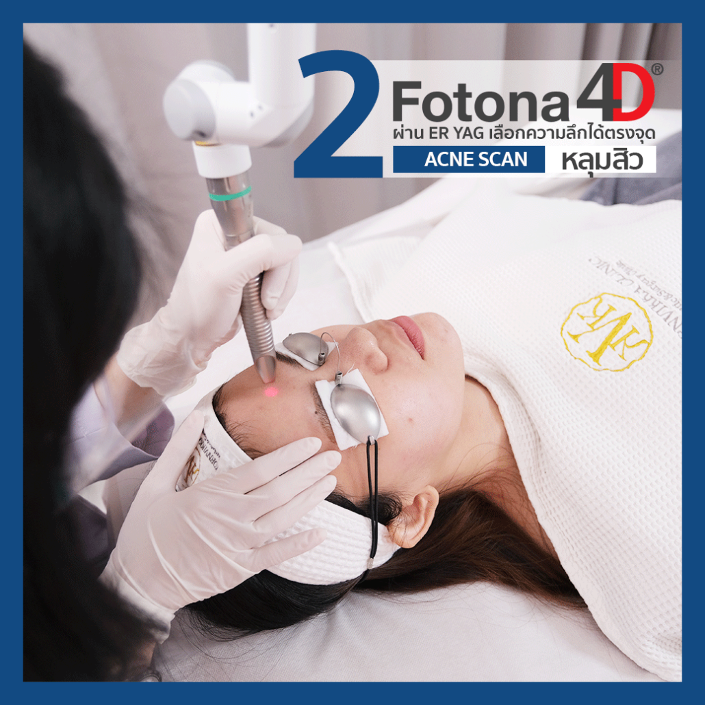 fotona4d