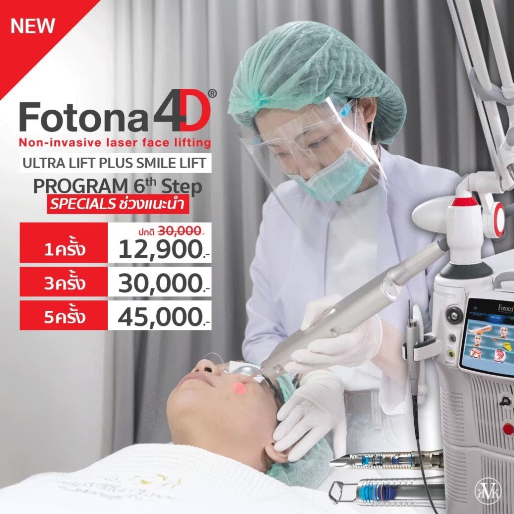 fotona 4d laser